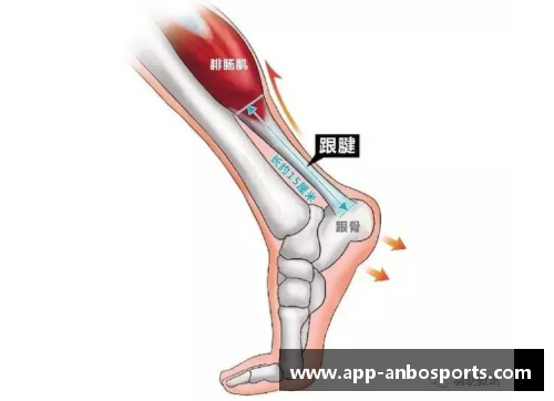 跟腱撕裂：重伤与复苏之路
